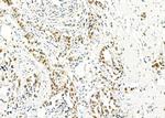 HEXIM1 Antibody in Immunohistochemistry (Paraffin) (IHC (P))