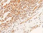 Phospho-Chk1 (Ser296) Antibody in Immunohistochemistry (Paraffin) (IHC (P))