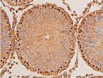 Phospho-Chk1 (Ser296) Antibody in Immunohistochemistry (Paraffin) (IHC (P))