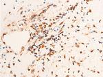 Phospho-Chk1 (Ser296) Antibody in Immunohistochemistry (Paraffin) (IHC (P))