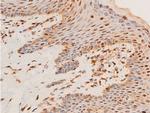 Phospho-Chk1 (Ser296) Antibody in Immunohistochemistry (Paraffin) (IHC (P))