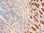 Phospho-Chk1 (Ser296) Antibody in Immunohistochemistry (Paraffin) (IHC (P))