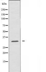 CCS Antibody in Western Blot (WB)