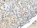 Phospho-CD227 (Mucin 1) (Tyr1229) Antibody in Immunohistochemistry (Paraffin) (IHC (P))