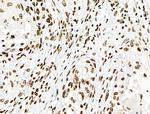 Phospho-CD227 (Mucin 1) (Tyr1229) Antibody in Immunohistochemistry (Paraffin) (IHC (P))