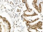 Phospho-CD227 (Mucin 1) (Tyr1229) Antibody in Immunohistochemistry (Paraffin) (IHC (P))