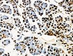 Phospho-CD227 (Mucin 1) (Tyr1229) Antibody in Immunohistochemistry (Paraffin) (IHC (P))