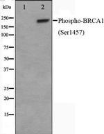 Phospho-BRCA1 (Ser1457) Antibody in Western Blot (WB)