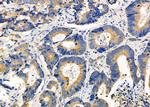 ADCK1 Antibody in Immunohistochemistry (Paraffin) (IHC (P))