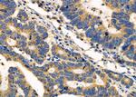 ADCK1 Antibody in Immunohistochemistry (Paraffin) (IHC (P))