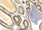 ADCK1 Antibody in Immunohistochemistry (Paraffin) (IHC (P))