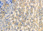 ADCK1 Antibody in Immunohistochemistry (Paraffin) (IHC (P))