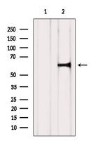 ADCK1 Antibody in Western Blot (WB)