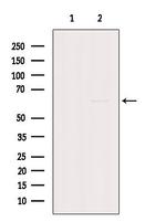 GK2 Antibody in Western Blot (WB)