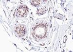 Phospho-Estrogen Receptor alpha (Ser104) Antibody in Immunohistochemistry (Paraffin) (IHC (P))