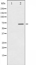 Phospho-Estrogen Receptor alpha (Ser104) Antibody in Western Blot (WB)