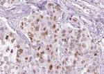 Phospho-ATM (Ser1981) Antibody in Immunohistochemistry (Paraffin) (IHC (P))