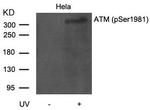 Phospho-ATM (Ser1981) Antibody in Western Blot (WB)