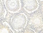 p47phox Antibody in Immunohistochemistry (Paraffin) (IHC (P))