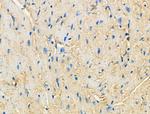 CCR7 Antibody in Immunohistochemistry (Paraffin) (IHC (P))