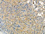 CCR7 Antibody in Immunohistochemistry (Paraffin) (IHC (P))