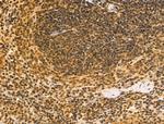 Cyclin A1 Antibody in Immunohistochemistry (Paraffin) (IHC (P))