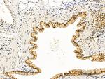 Cyclin A1 Antibody in Immunohistochemistry (Paraffin) (IHC (P))