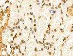 Cyclin A1 Antibody in Immunohistochemistry (Paraffin) (IHC (P))