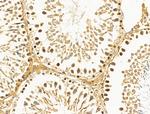 HSPH1 Antibody in Immunohistochemistry (Paraffin) (IHC (P))