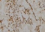 HSPH1 Antibody in Immunohistochemistry (Paraffin) (IHC (P))