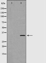 Phospho-Cyclin D2 (Thr280) Antibody in Western Blot (WB)