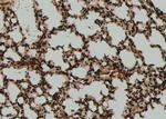 Phospho-SF1 (Ser80, Ser82) Antibody in Immunohistochemistry (Paraffin) (IHC (P))