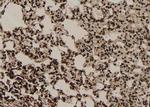 Phospho-SF1 (Ser80, Ser82) Antibody in Immunohistochemistry (Paraffin) (IHC (P))