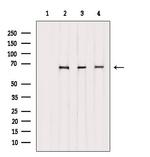 Phospho-SF1 (Ser80, Ser82) Antibody in Western Blot (WB)