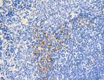 Phospho-MYL2 (Ser15) Antibody in Immunohistochemistry (Paraffin) (IHC (P))