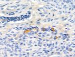 Phospho-MYL2 (Ser15) Antibody in Immunohistochemistry (Paraffin) (IHC (P))