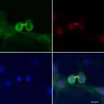 Phospho-MYL2 (Ser15) Antibody in Immunocytochemistry (ICC/IF)