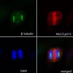 Phospho-MYL2 (Ser15) Antibody in Immunocytochemistry (ICC/IF)