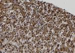 MAGEA12 Antibody in Immunohistochemistry (Paraffin) (IHC (P))