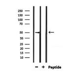 HTR3D Antibody in Western Blot (WB)