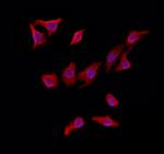 MAT2B Antibody in Immunocytochemistry (ICC/IF)