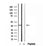 MAT2B Antibody in Western Blot (WB)