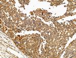 NOD2 Antibody in Immunohistochemistry (Paraffin) (IHC (P))