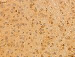 NOD2 Antibody in Immunohistochemistry (Paraffin) (IHC (P))