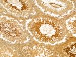 AP1M1 Antibody in Immunohistochemistry (Paraffin) (IHC (P))