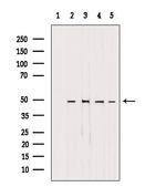 AP1M1 Antibody in Western Blot (WB)