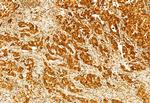 GSDMD Antibody in Immunohistochemistry (Paraffin) (IHC (P))