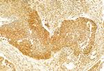 GSDMD Antibody in Immunohistochemistry (Paraffin) (IHC (P))