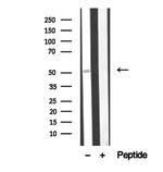 BBS4 Antibody in Western Blot (WB)