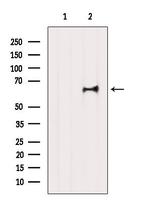 IkB zeta Antibody in Western Blot (WB)